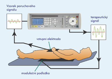 http://www.bicom-optima.cz/images/schema.gif